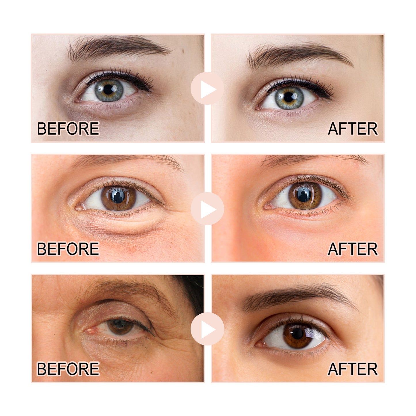 HOYGI Retinol Eye Serum