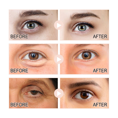 HOYGI Retinol Eye Serum
